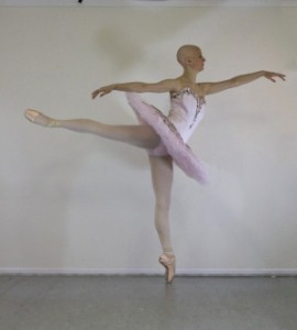 COURTESY MAGGIE KUDIRKA Maggie Kudirka was diagnosed with Stage 4 breast cancer while a dancer with the Joffrey Concert Group.